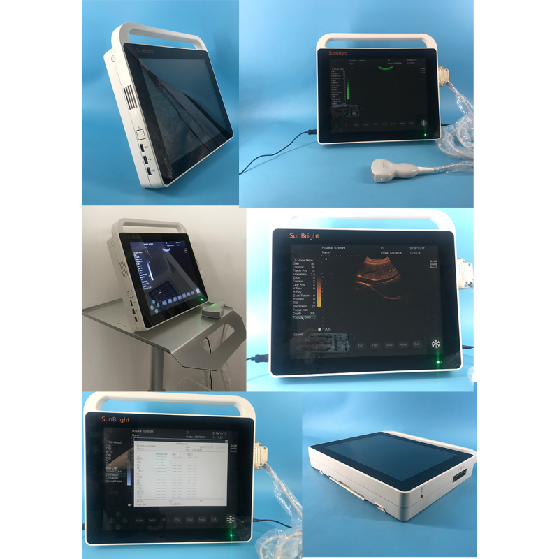 Mindray 초음파 기계 ultrasonido Mindray m7 echograph portabl 가격 Mindray 초음파 장치