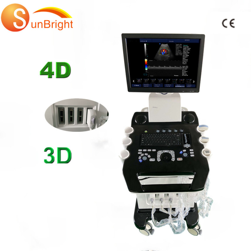 Cheapest Price SUN-908C mobile Color Doppler 3D 4D Portable Ecografo Chison For Sale eco doppler color