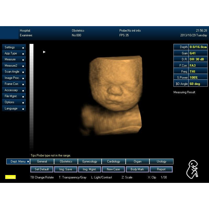 portable home baby ultrasound machine