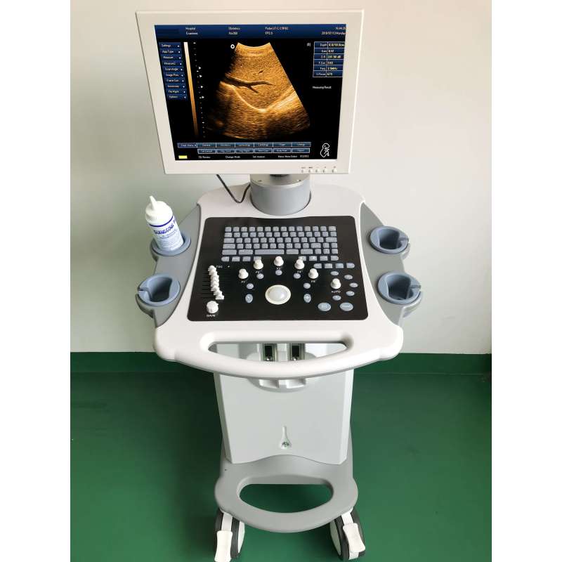 Factory Price Portable high quality 3d ultrasound machine trolley for hospital