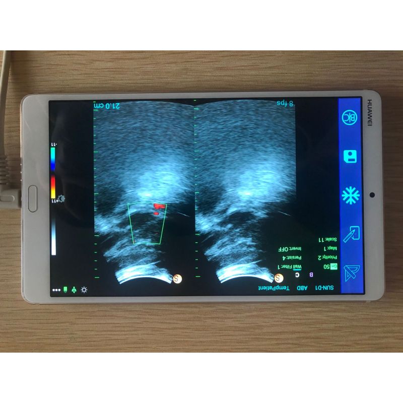 Cardiac 4D Echocardiography Echo Machine color doppler probe ultrasound wireless with Convex Probe