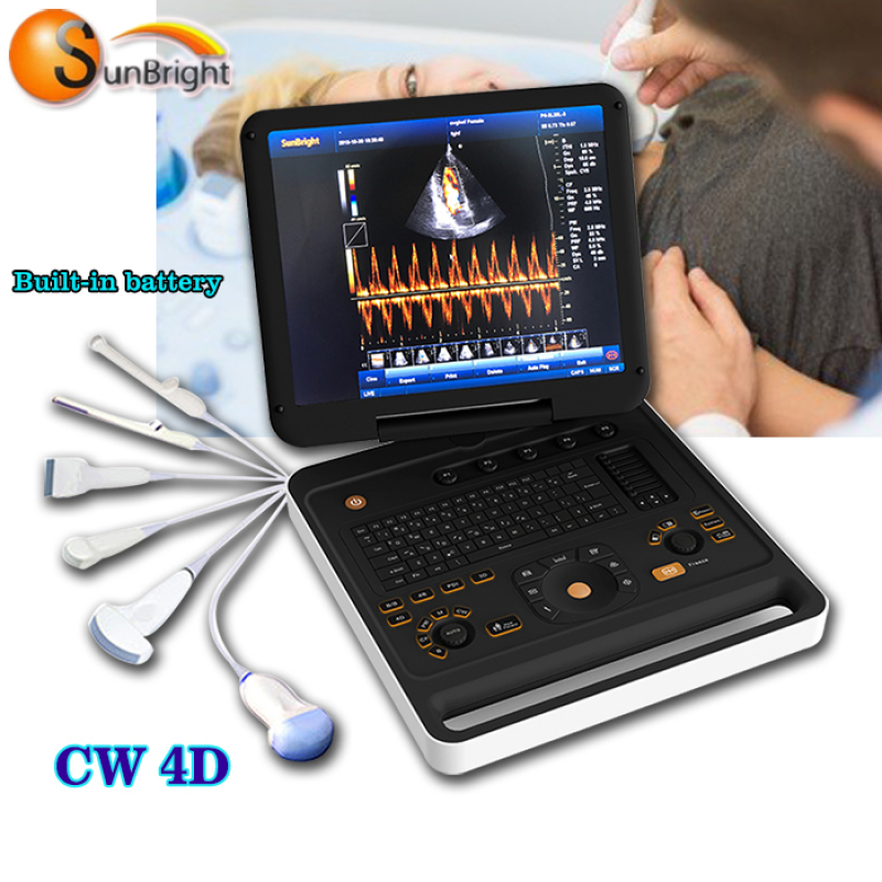 High quality Portable color doppler Ultrasound Scanner 4B display USB port to transfer data