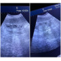 Laptop ultrasound machine Advanced ultrasound machine cheapest medical ultrasound