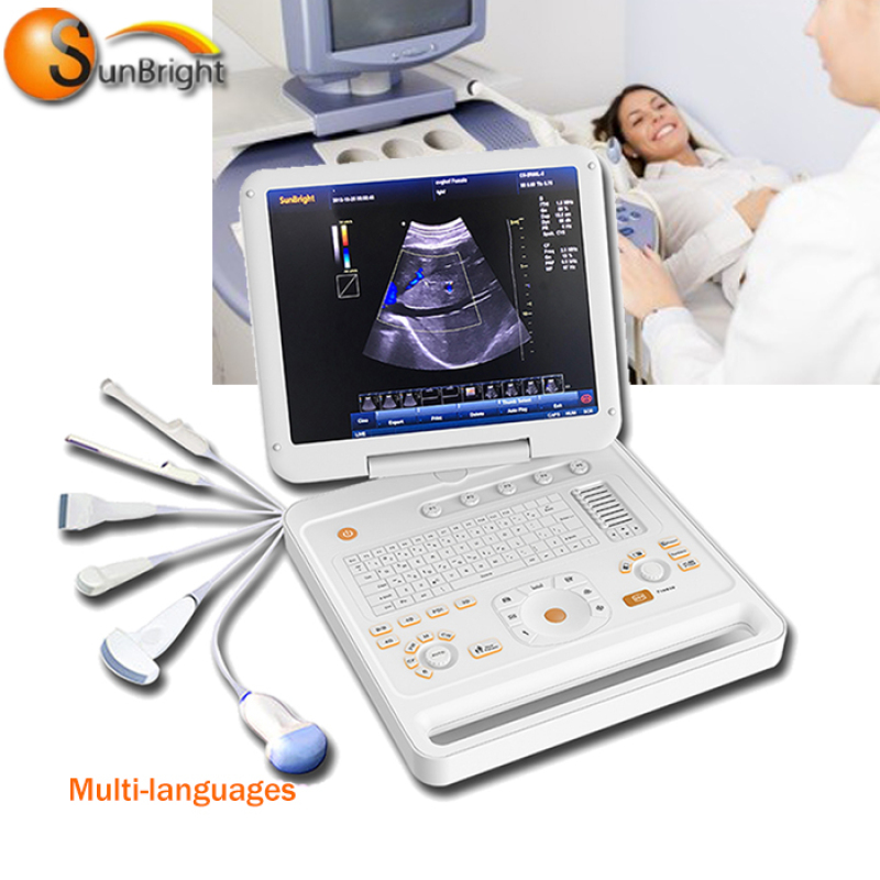portable 3d scanner price color Doppler ultrasound pregnancy color Doppler