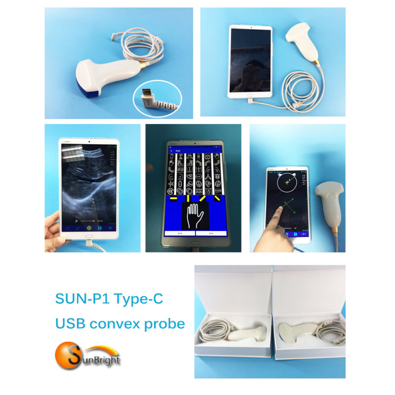 Leicht zu tragende USB-Ultraschallsonde mit eingebautem Akku, kabellos, digital, klares Bild, Doppler-USB-Ultraschallsonde