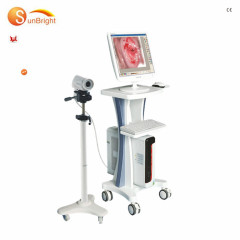 Medical gynecology equipment high end vagina diagnostic full digital colposcope