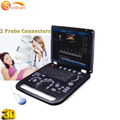 Updated 3D diagnostic ultrasound machine for sale medical ecography ultrasound equipment