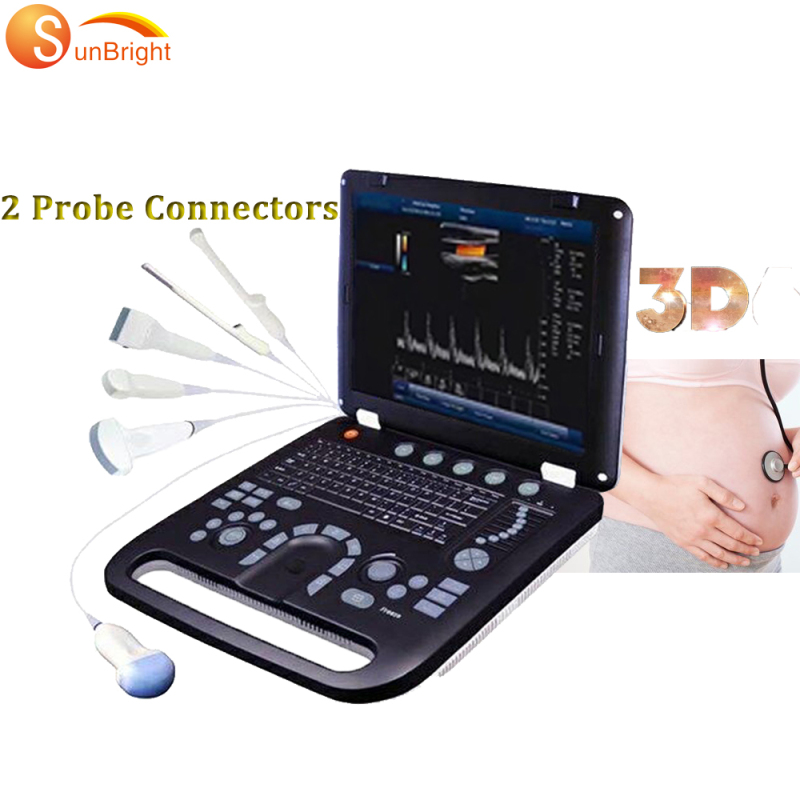 OB 3D scan color doppler vascular MSK digital ultrasound machine