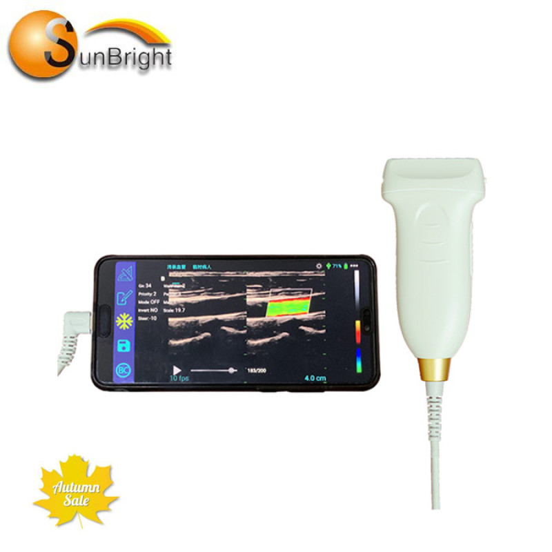 Sonda de ultrasonidos inalámbrica USB Sunbright, sonda de ultrasonidos lineal de 14 MHz, Doppler color