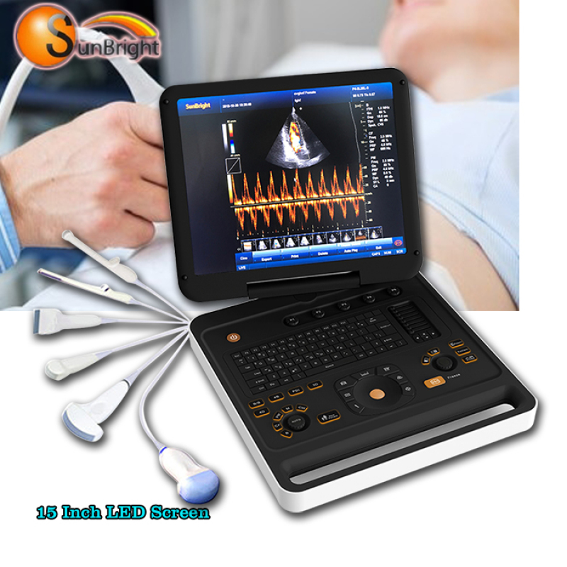 similar with sonoscape echocardiography laptop 4D high end Doppler scanner