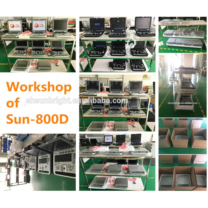 Medical hospital high quality standard digital portable laptop best selling ultrasound machine