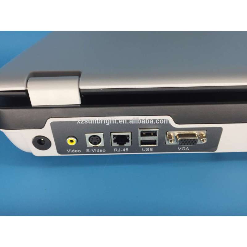 equipo de ginecología digital completo máquina de ultrasonido portátil 3D 4D