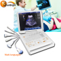Portable Laptop 3D Two Probe Connectors Color Doppler diagnosis ultrasound Machine
