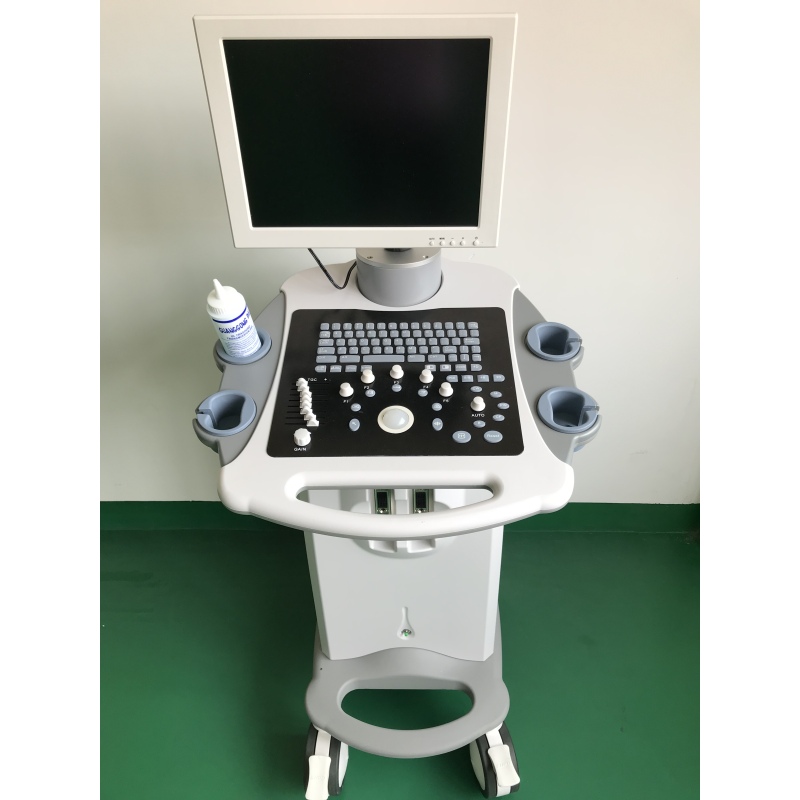 Hot sale Sonoscape 3D 4D general electric trolley ultrasound Scanner Echo Ultrasound