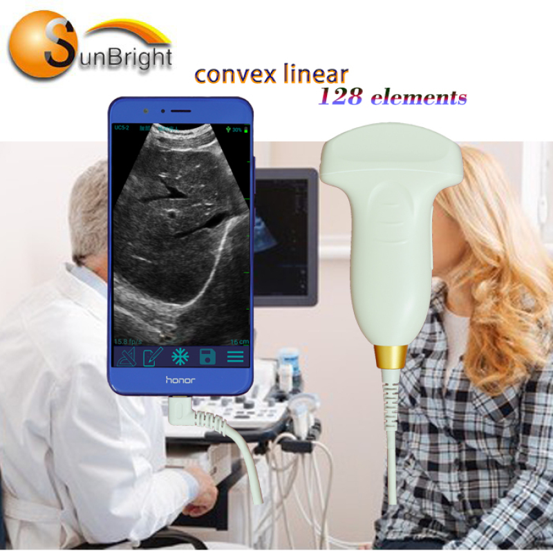 تعمل بسهولة واي فاي الماسح الضوئي بالموجات فوق الصوتية USB توصيل المسبار بأسعار تنافسية