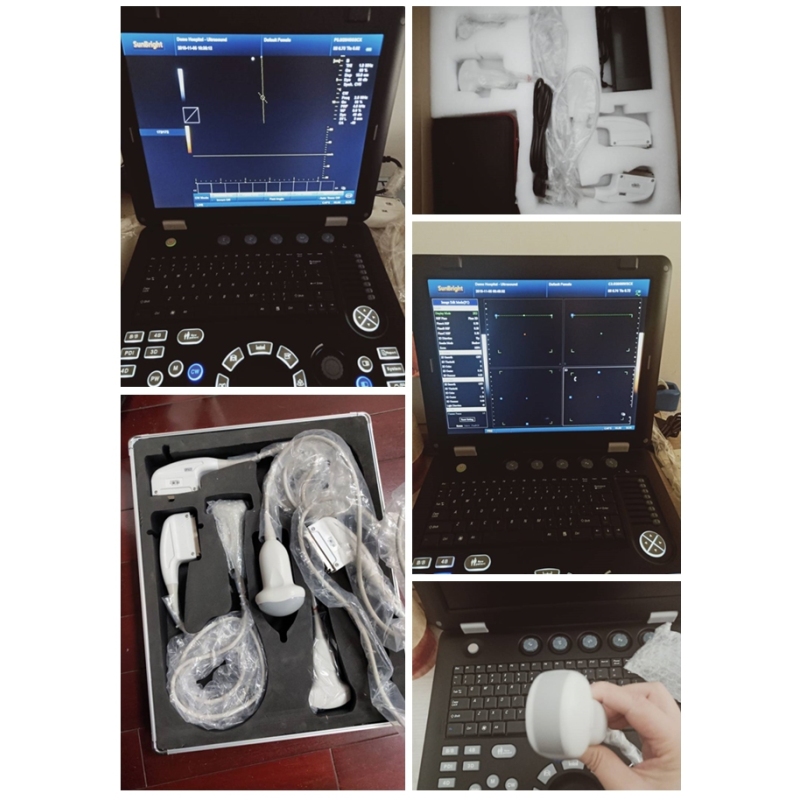 Portable 3D/4D CW Color Doppler price Digital Ultrasonic Diagnostic Machine