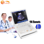 siemens ultrasound machine competitive price Doppler