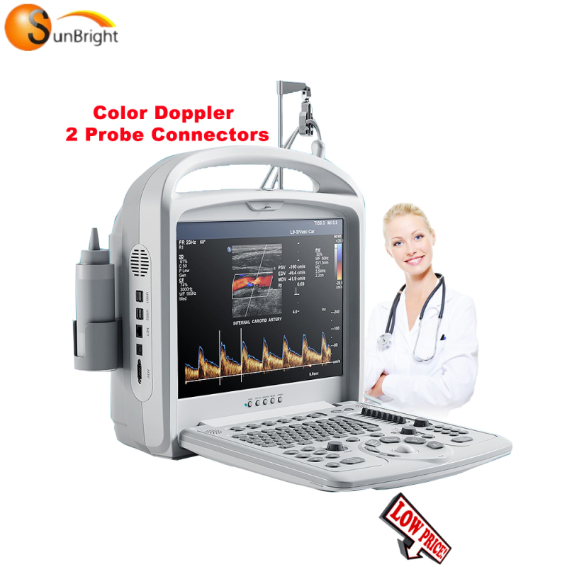Medical Equipment Fetal Color Doppler portable diagnostic ultrasound machine