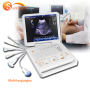 Laptop 3D color Doppler machine hospital ultrasound scanner medical equipment