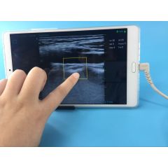 Wireless usb probe ultrasound scanner smart phone ultrasound USB Linear probe vascular handheld