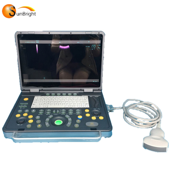 Best seller portable 2D 3D laptop echo machine ultrasonic scanner