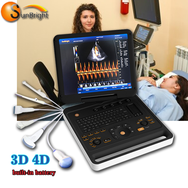 Portable B/W sonoscape color doppler machine with Digital Ultrasound Diagnostic Imaging System