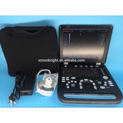 veterinary color doppler ultrasound 3D function system one key changed for human use