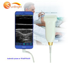 wireless color images PW ultrasound scanner USB smart phone Linear probe