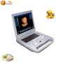 Newest technical portable 2d 3d ultrasound scanner machine for human pregnancy