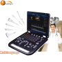 Real time 4d ultrasound scanner portable color doppler 3d 4d ultrasound scanner color doppler
