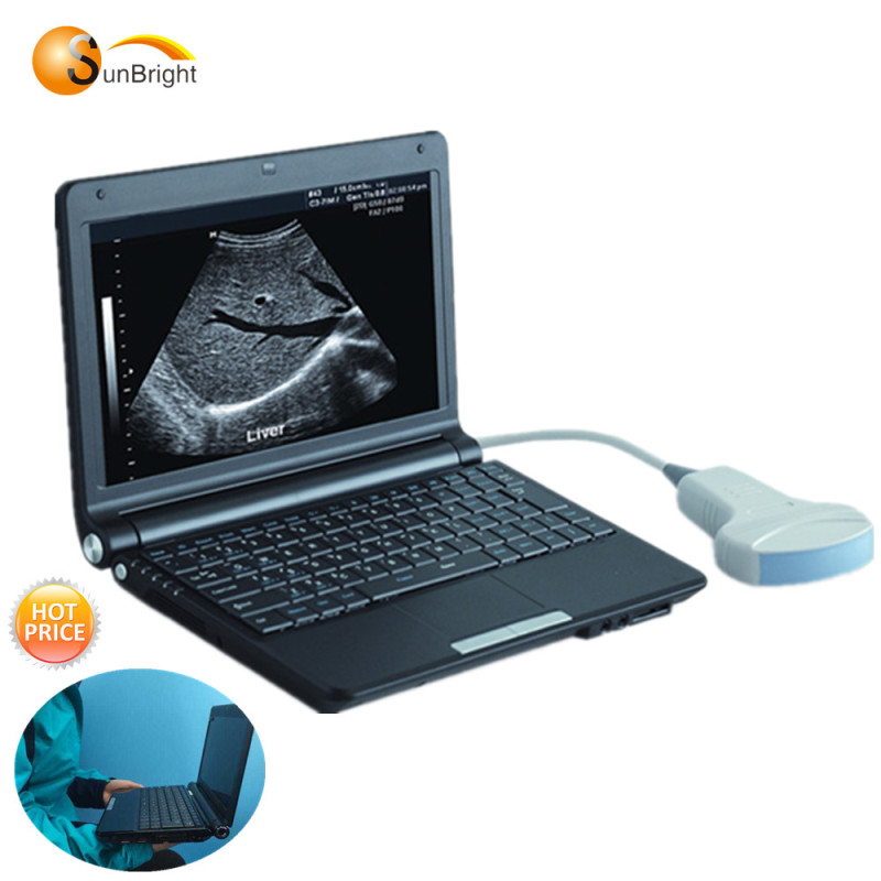 Sehr beliebter Mini-Laptop-Ultraschallscanner zum Fabrikpreis