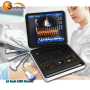 scanner echographe laptop 3D 4D CW PW color Doppler ultrasound machine