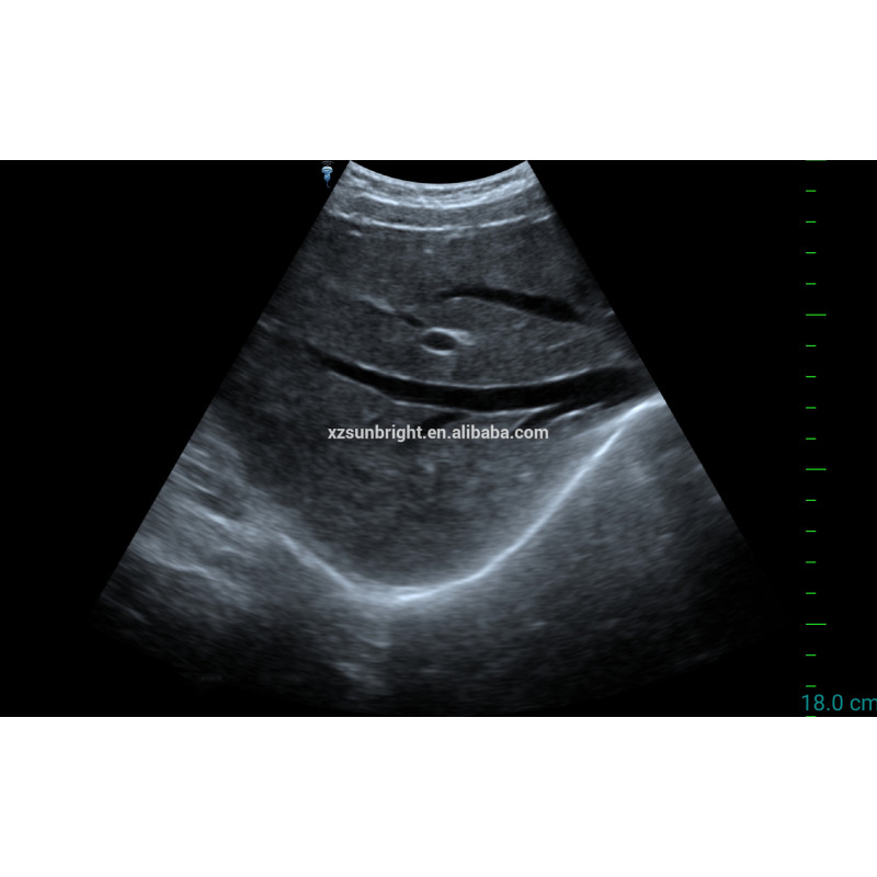 Big sale!!! Handheld USB convex probe mini ultrasound wireless probe