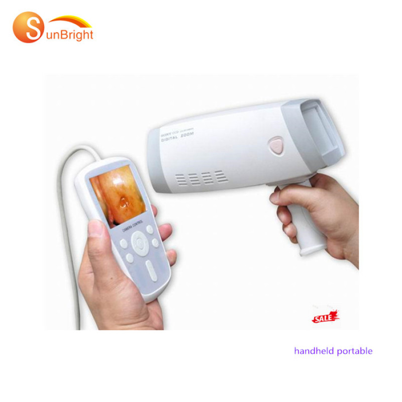 high-resolution images Camera Digital Video Colposcope price For Gynecology