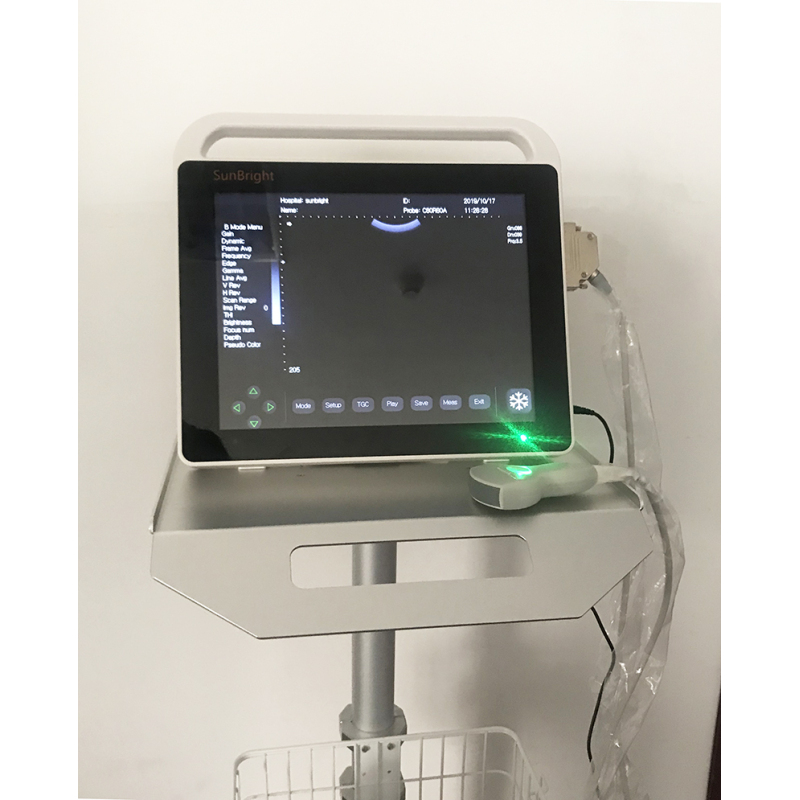 High Resolution LED 15 Inch Touch Screen Ultrasound Device Echocardiography potable ultrasound scanner Wireless