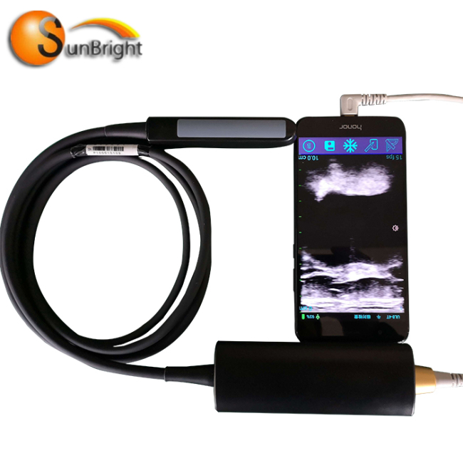 High quality portable Type-C USB rectal ultrasound probe