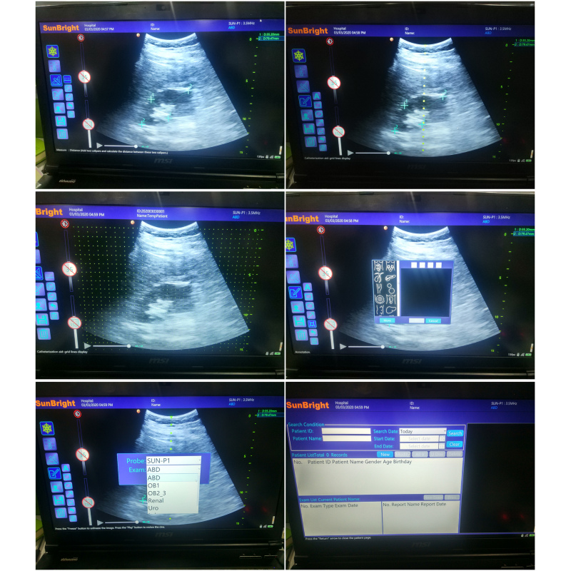 high digital image portable handheld medical linear convex cheapest ultrasound probe