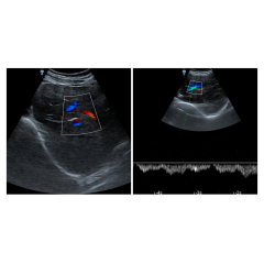 wireless usg ultrasound double head color Doppler probe hand vascular scanner