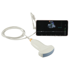 wireless color Doppler ultrasound USB type C smart phone convex probe