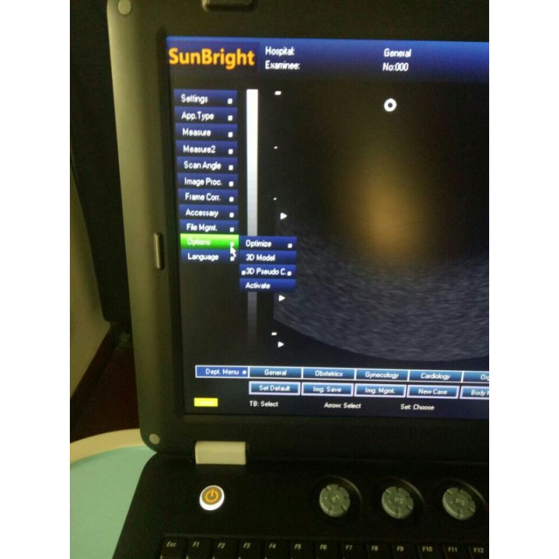 최고의 가격 휴대용 초음파 시스템 노트북 흑백 초음파 스캐너 진단 3D 초음파 기계