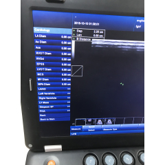 Vascular ultrasound elastography laptop 3D color doppler portable ultrasound machine low price