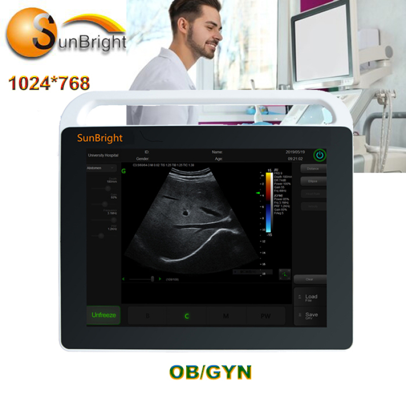 휴대용 에코 풀 디지털 초음파 2d 진단 스캐너