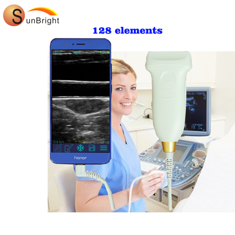미니 초음파 SUN-P2 공장 가격 USB 7.5Mhz 스마트폰 혈관 선형 프로브