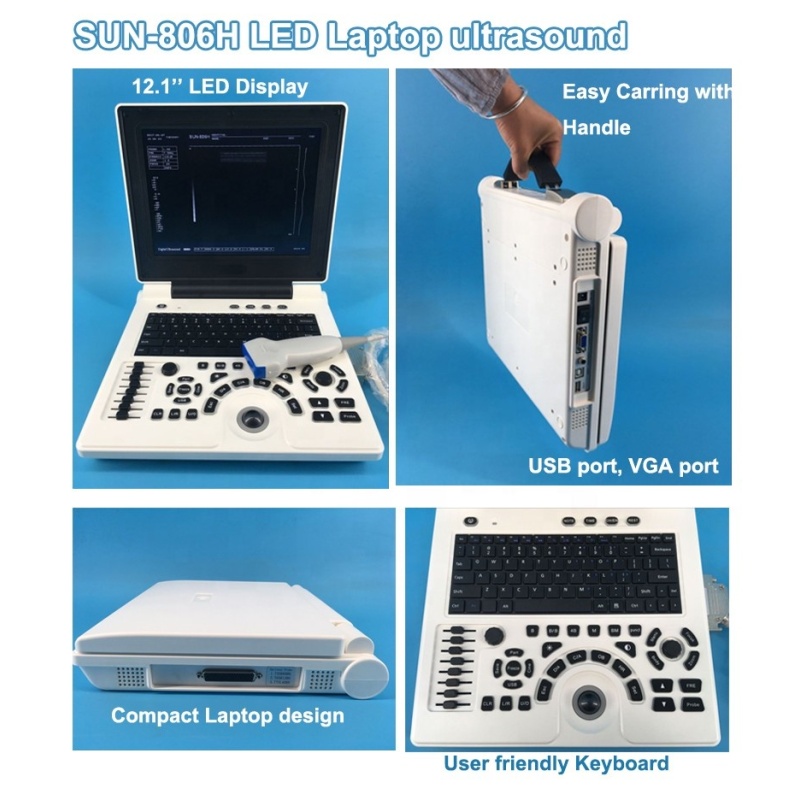 Black and White 2D medical portable laptop ultrasound scanner machine price