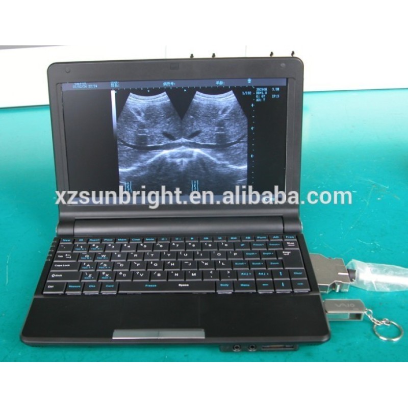 Factory sell directly laptop ultrasonic machine CE approved
