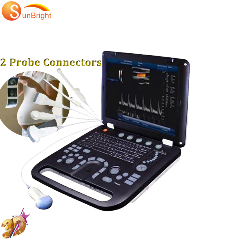 High quality laptop Ultrasound Doppler Portable Ultrasound System doppler ultrasound portable