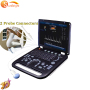 High quality laptop Ultrasound Doppler Portable Ultrasound System doppler ultrasound portable