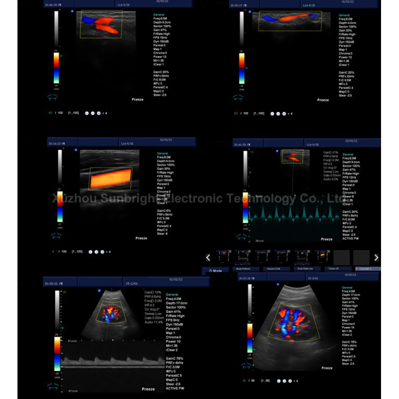 19 Zoll LED Vascular PW Farbdoppler-Ultraschallgerätewagen
