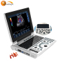 High resolution clinic medical device 2D portable B/W ultrasound machine