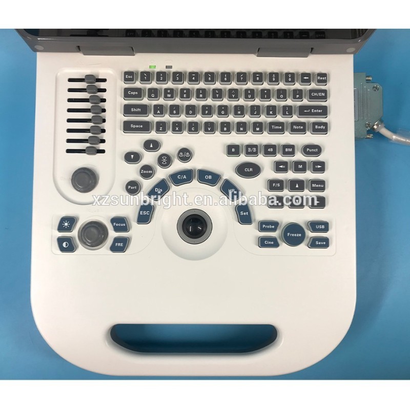 سوبر سبتمبر نوعية جيدة الماسح الضوئي آلة الموجات فوق الصوتية للكمبيوتر المحمول